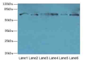 Polyclonal Rabbit anti-Human TMCC1 Antibody (IHC, WB)