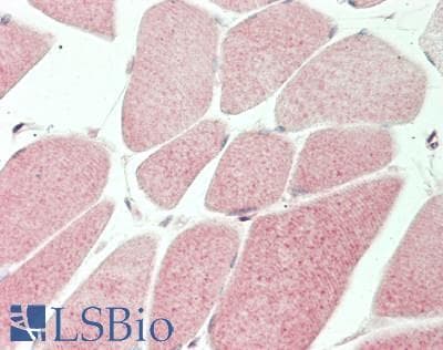 IHC-plus™ Polyclonal Rabbit anti-Human MT-ND5 Antibody (aa544-570, IHC, WB)