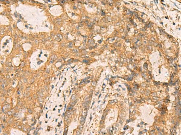 CNST Antibody
