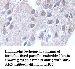 AK5 / Adenylate Kinase 5 Antibody (Internal)