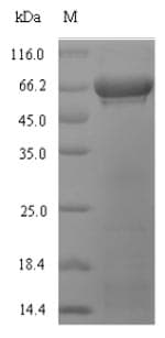 Soybean rbcL Protein (Recombinant 6His-SUMO, N-terminus)