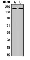 CSF1R / CD115 / FMS Antibody (C-Terminus)