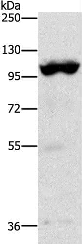 Polyclonal Rabbit anti-Human TRPM5 Antibody (IHC, WB)