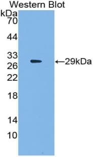 SRF / Serum Response Factor Antibody (aa231-474)