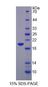 Rabbit MMP9 / Gelatinase B Protein (Recombinant His-S)