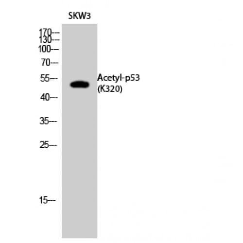 TP53 / p53 Antibody (around the acetylation site of K320.)