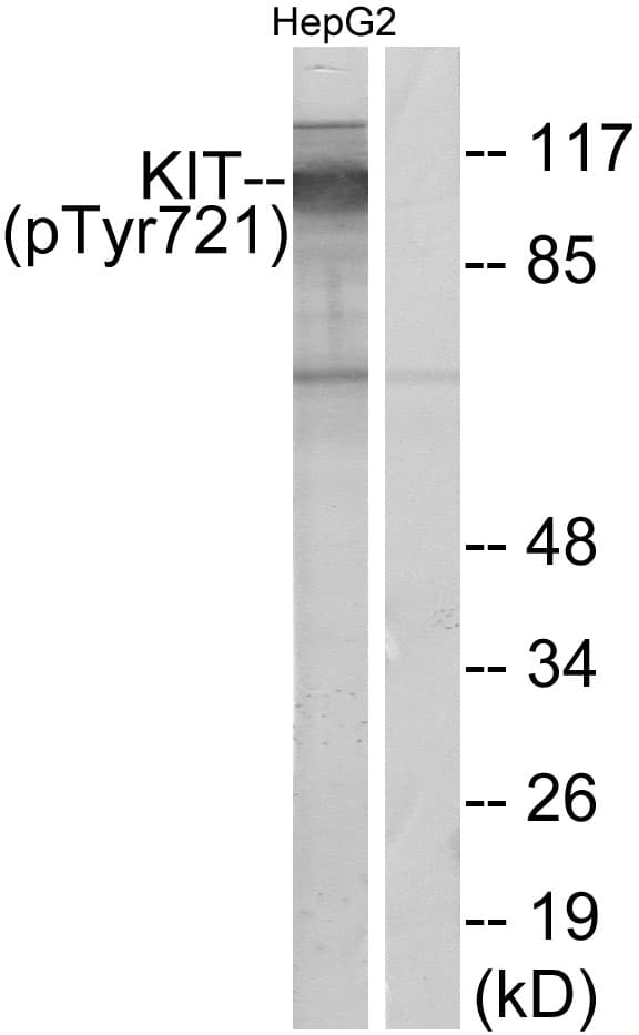 Polyclonal Rabbit anti-Human c-Kit / CD117 Antibody (phospho-Tyr721, WB)