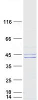 Human UBE2J1 Protein (Recombinant Myc-DDK (Flag))