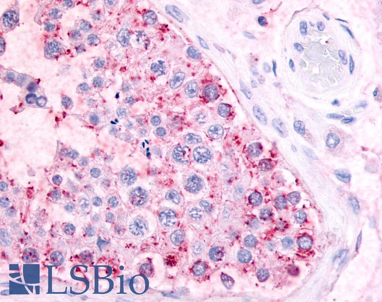 IHC-plus™ Polyclonal Rabbit anti-Human MAS1 / MAS Antibody (Extracellular Domain, IHC)