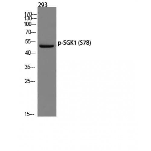SGK1 / SGK Antibody (10-90 aa)