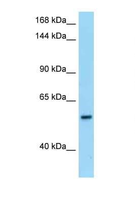 PDE6B / PDE6 Beta Antibody (aa105-154)