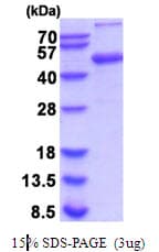 Mouse AHSG / Fetuin A Protein (Recombinant His)