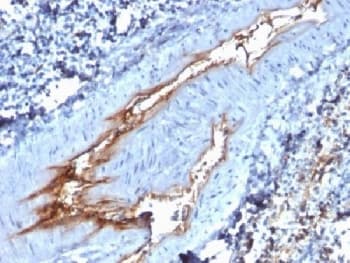 VWF / Von Willebrand Factor Antibody (clone VWF/1767, Azide-free, BSA-free)
