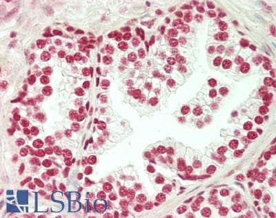 IHC-plus™ SET / TAF-I Antibody (aa47-75)