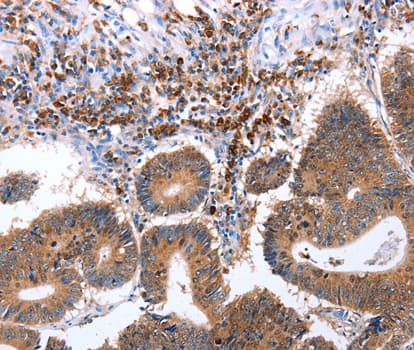 IHC-plus™ Polyclonal Rabbit anti-Human CNTFR Antibody (IHC, WB)