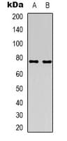 ACSS1 Antibody (C-Terminus)