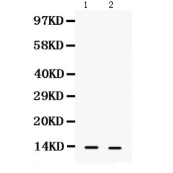 Polyclonal Rabbit anti-Human S100A9 / MRP14 Antibody (aa2-114, IHC, WB)