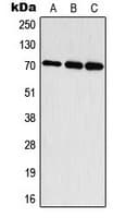 Polyclonal Rabbit anti-Human RPS6KB1 / P70S6K / S6K Antibody (phospho-Thr444, IHC, IF, WB)
