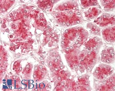 IHC-plus™ CTSD / Cathepsin D Antibody (aa 67-403)