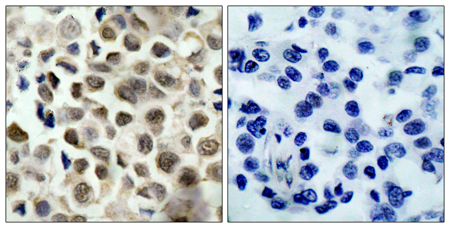 Polyclonal Rabbit anti-Human HDAC8 Antibody (phospho-Ser39, IHC, WB)