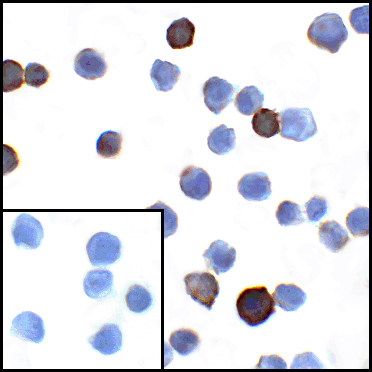 CD274 / B7-H1 / PD-L1 Antibody (clone 1D7)