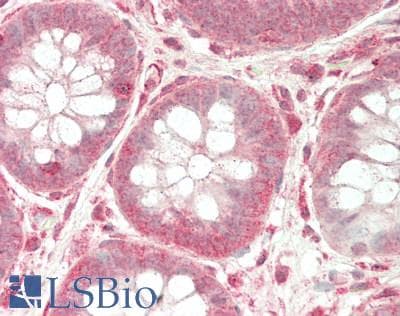 IHC-plus™ E6AP / UBE3A Antibody (aa342-585)