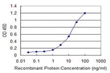 LRG1 / LRG Antibody (clone 1H1)