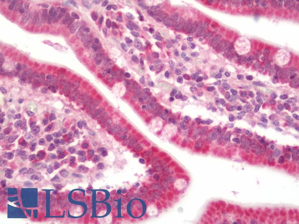 IHC-plus™ DNTTIP1 / TDIF1 Antibody