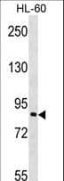 Polyclonal Rabbit anti-Human NAP1 / TAB3 Antibody (aa1-30, WB)