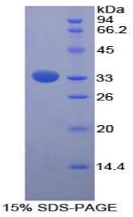 Rat Alpha Fucosidase / FUCA1 Protein (Recombinant His-T7)