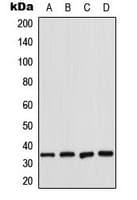 Polyclonal Rabbit anti-Human CDK2 Antibody (Internal, IHC, WB)