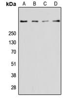 Polyclonal Rabbit anti-Human RYR2 / Ryanodine Receptor 2 Antibody (Internal, WB)