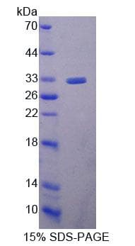 Mouse UBE2S / E2 EPF Protein (Recombinant His-T7, N-terminus)
