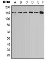 CASR/Calcium Sensing Receptor Antibody (phospho-Thr888)