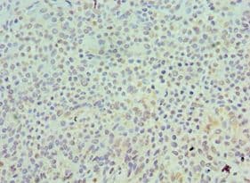 SKP1 Antibody (aa1-163)