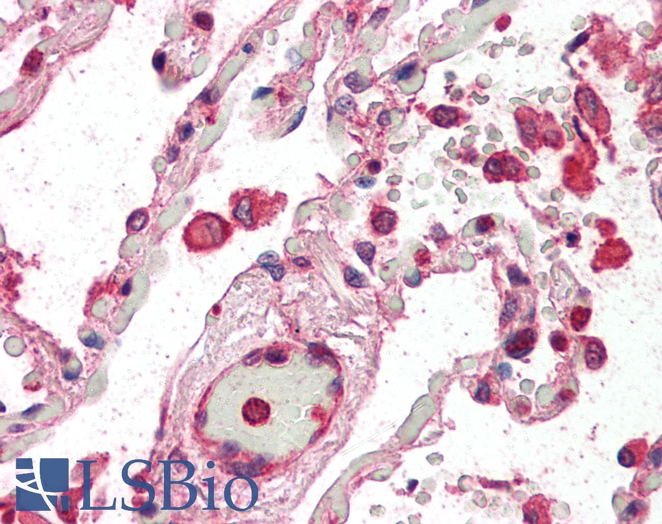 IHC-plus™ ACAP2 / Centaurin Beta 2 Antibody (aa766-778)