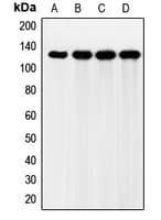 Polyclonal Rabbit anti-Human FGFR2 / FGF Receptor 2 Antibody (Internal, IHC, WB)