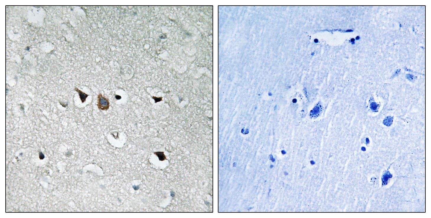 RAF1 / RAF Antibody