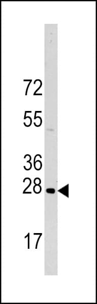 HSPB1 / HSP27 Antibody (Ser83)