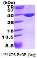 Human LDHA / LDH1 Protein (Recombinant His)