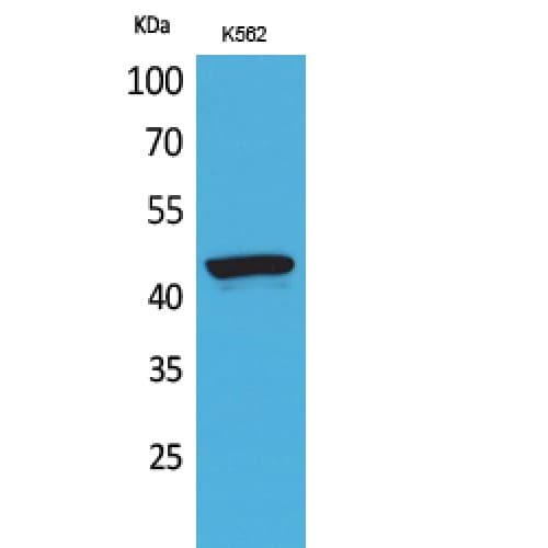 Polyclonal Rabbit anti-Human P2RX3 / P2X3 Antibody (71-120 aa, Internal, WB)