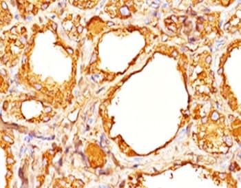 TG / Thyroglobulin Antibody (clone 2H11 + 6E1 or TGB04 + TGB05, Azide-free, BSA-free)