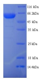Human TRIM21 / RO52 Protein (Recombinant 6His, N-terminus)