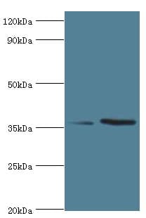 Polyclonal Rabbit anti-Human WDR77 / MEP50 Antibody (aa1-260, IHC, WB)