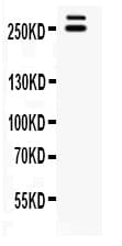 Polyclonal Rabbit anti-Human WNK1 Antibody (IHC, WB)