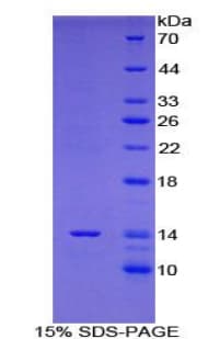 Mouse GAL / Galanin Protein (Recombinant His-T7)