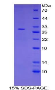 Human PIAS1 Protein (Recombinant His-T7)
