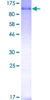 Human MDM2 Protein (Recombinant GST)