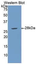 LBP Antibody (aa226-438, Cy3)