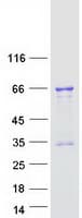 Human TCF3 / E2A Protein (Recombinant Myc-DDK (Flag))